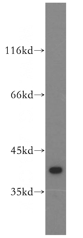 HeLa cells were subjected to SDS PAGE followed by western blot with Catalog No:110361(ERK1/2 antibody) at dilution of 1:1000