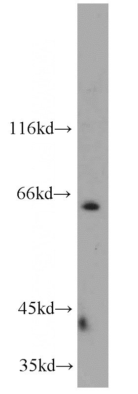HEK-293 cells were subjected to SDS PAGE followed by western blot with Catalog No:113100(NEIL3 antibody) at dilution of 1:500
