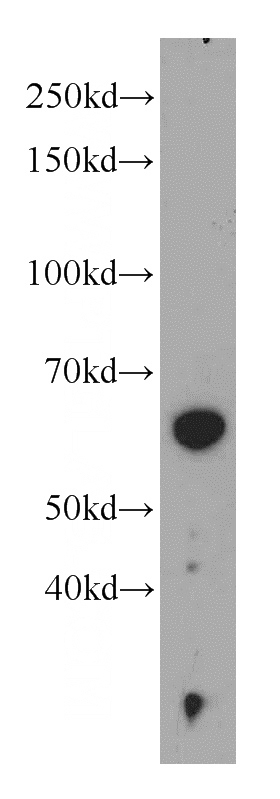 MCF7 cells were subjected to SDS PAGE followed by western blot with Catalog No:113856(PKLR antibody) at dilution of 1:1000