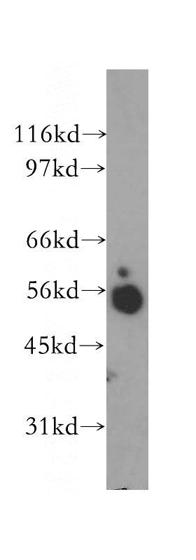 human brain tissue were subjected to SDS PAGE followed by western blot with Catalog No:115776(SYT4 antibody) at dilution of 1:400