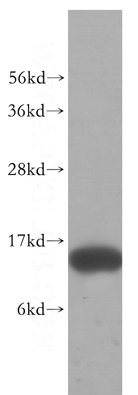 human brain tissue were subjected to SDS PAGE followed by western blot with Catalog No:110443(FABP7 antibody) at dilution of 1:500