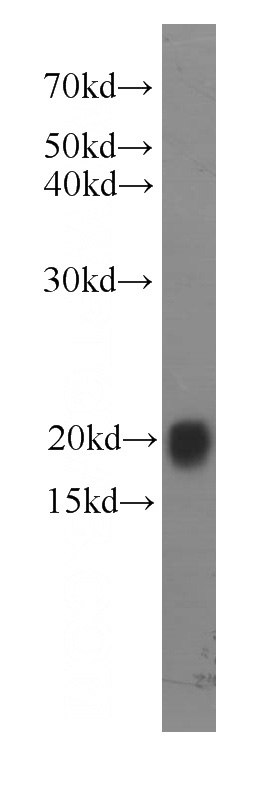 HL-60 cells were subjected to SDS PAGE followed by western blot with Catalog No:107495(RAC2 antibody) at dilution of 1:500