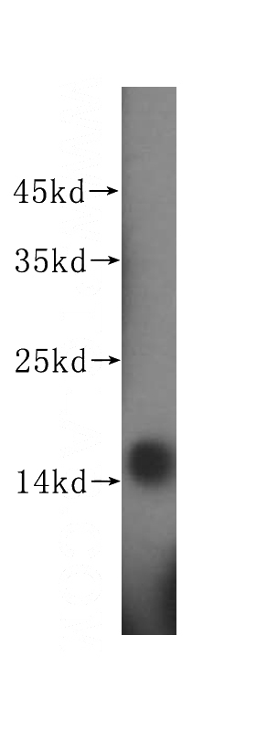 HeLa cells were subjected to SDS PAGE followed by western blot with Catalog No:113735(PFDN4 antibody) at dilution of 1:300