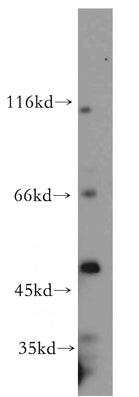 K-562 cells were subjected to SDS PAGE followed by western blot with Catalog No:113168(NFYC antibody) at dilution of 1:1000