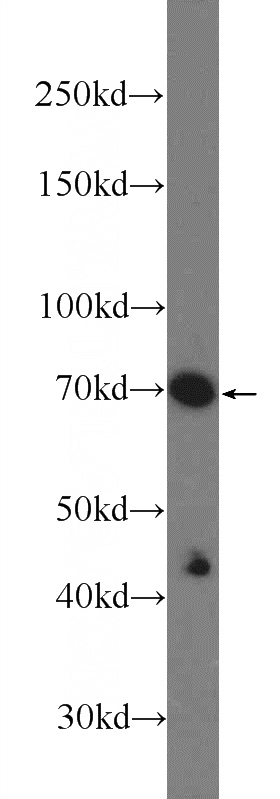 PC-3 cells were subjected to SDS PAGE followed by western blot with Catalog No:108946(CBX4 Antibody) at dilution of 1:600