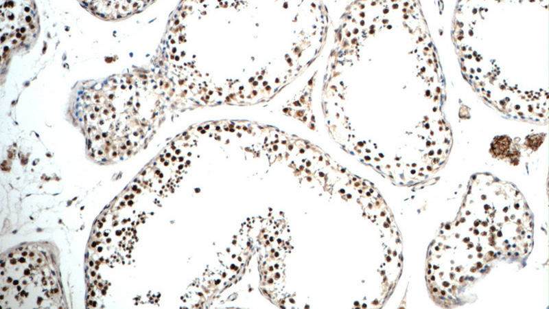 Immunohistochemistry of paraffin-embedded human testis tissue slide using Catalog No:107885(ALS2CR8 Antibody) at dilution of 1:50 (under 10x lens)