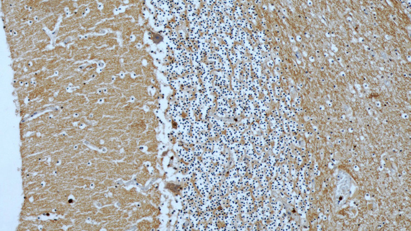 Immunohistochemical of paraffin-embedded human cerebellum using Catalog No:108882(CASPR antibody) at dilution of 1:50 (under 10x lens)