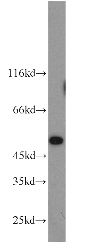 MCF7 cells were subjected to SDS PAGE followed by western blot with Catalog No:112878(RP6-213H19.1 antibody) at dilution of 1:800