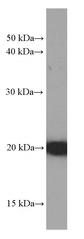 HeLa cells were subjected to SDS PAGE followed by western blot with Catalog No:107347(IMP3 Antibody) at dilution of 1:2000