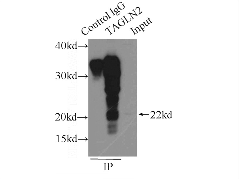 IP Result of anti-Transgelin-2-specific (IP:Catalog No:116335, 3ug; Detection:Catalog No:116335 1:500) with L02 cells lysate 1000ug.