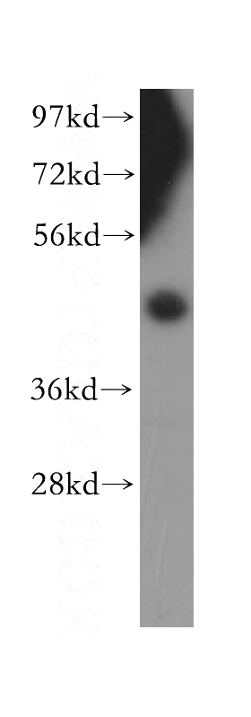 HEK-293 cells were subjected to SDS PAGE followed by western blot with Catalog No:115146(SFRP4 antibody) at dilution of 1:400