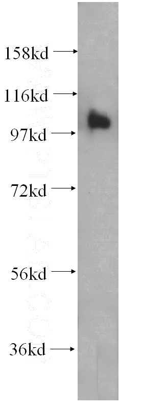HeLa cells were subjected to SDS PAGE followed by western blot with Catalog No:114471(RASA3 antibody) at dilution of 1:500