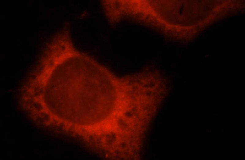 Immunofluorescent analysis of MCF-7 cells, using TXNRD1 antibody Catalog No:116458 at 1:25 dilution and Rhodamine-labeled goat anti-rabbit IgG (red).