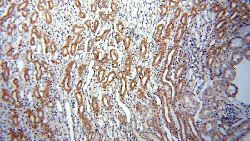 Immunohistochemical of paraffin-embedded human kidney using Catalog No:107908(AFG3L2 antibody) at dilution of 1:50 (under 10x lens)