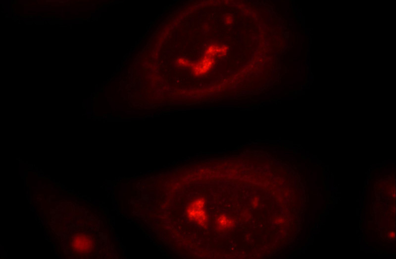 Immunofluorescent analysis of HepG2 cells using Catalog No:110079(DNA2 Antibody) at dilution of 1:25 and Rhodamine-Goat anti-Rabbit IgG