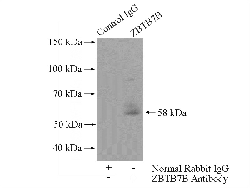 IP Result of anti-ZBTB7B (IP:Catalog No:116920, 4ug; Detection:Catalog No:116920 1:300) with mouse skin tissue lysate 3200ug.