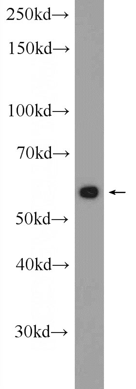 HepG2 cells were subjected to SDS PAGE followed by western blot with Catalog No:115215(SESN3 Antibody) at dilution of 1:600