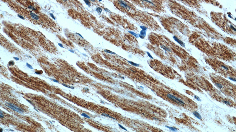 Immunohistochemical of paraffin-embedded human heart using Catalog No:111285(HCN2 antibody) at dilution of 1:50 (under 40x lens)