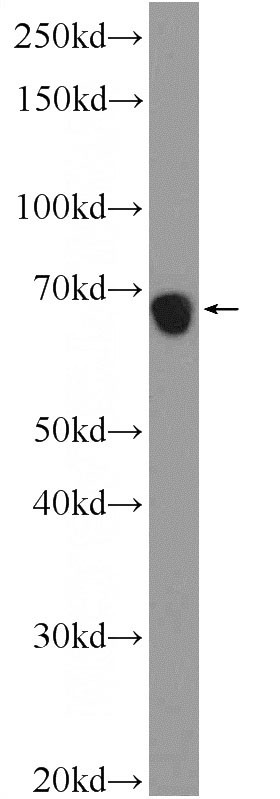 mouse testis tissue were subjected to SDS PAGE followed by western blot with Catalog No:116965(ZNF251 Antibody) at dilution of 1:600