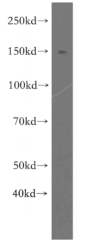 HeLa cells were subjected to SDS PAGE followed by western blot with Catalog No:110727(FMNL1 antibody) at dilution of 1:300
