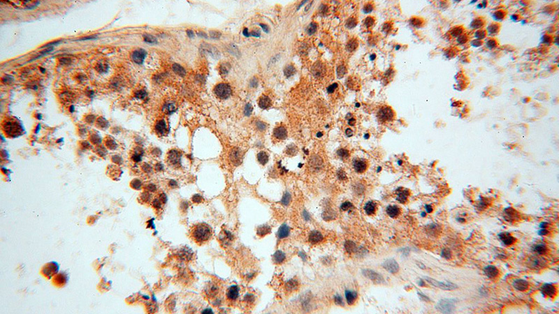 Immunohistochemical of paraffin-embedded human testis using Catalog No:112344(LSG1 antibody) at dilution of 1:50 (under 40x lens)