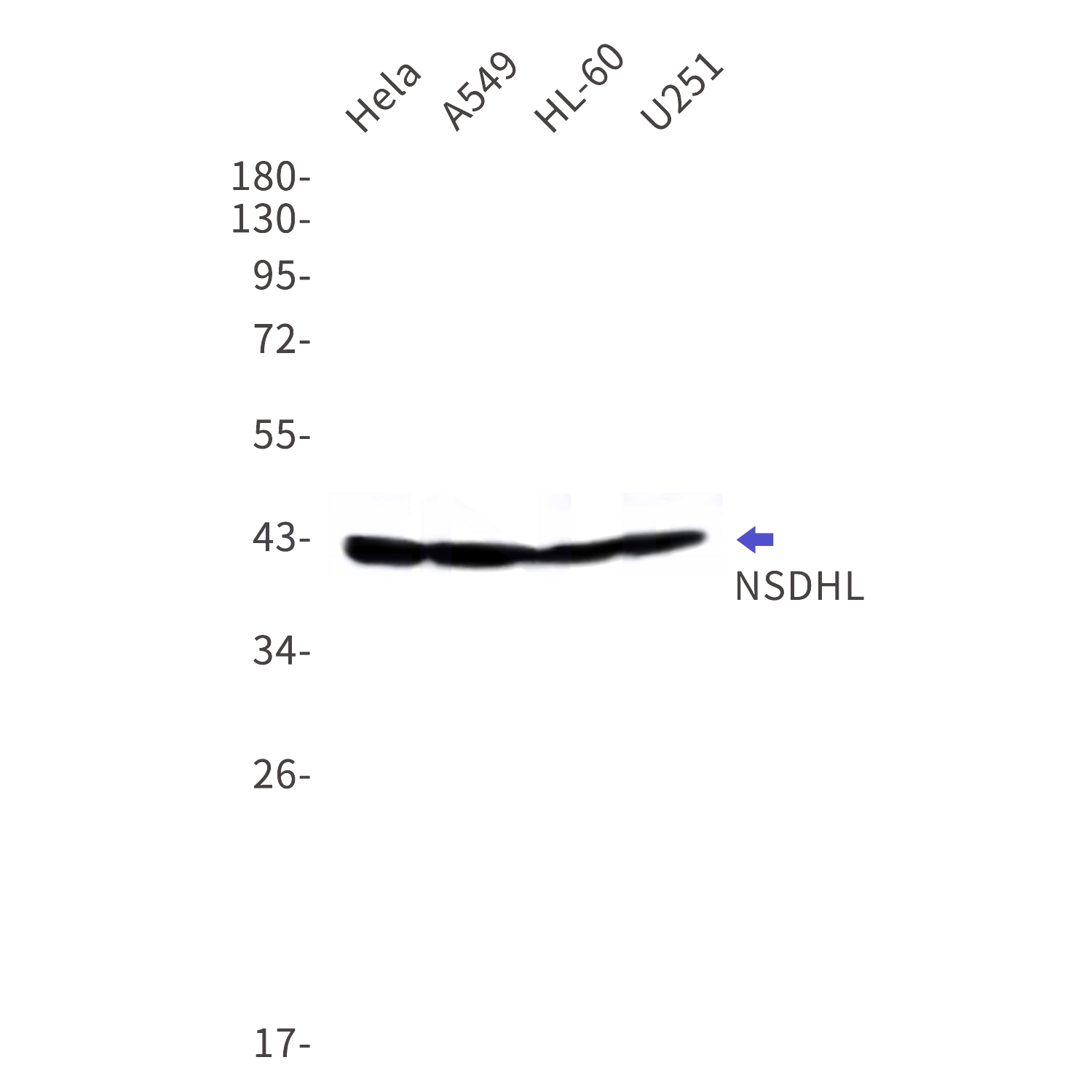 Western blot detection of NSDHL in Hela,A549,HL-60,U251 cell lysates using NSDHL Rabbit mAb(1:1000 diluted).Predicted band size:42kDa.Observed band size:42kDa.