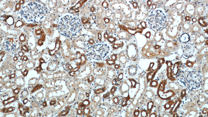Immunohistochemistry of paraffin-embedded human kidney slide using Catalog No:109075(CCR2a-specific Antibody) at dilution of 1:50