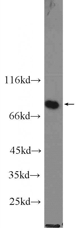 K-562 cells were subjected to SDS PAGE followed by western blot with Catalog No:114845(RPS6KA3 antibody) at dilution of 1:1000