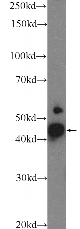 mouse brain tissue were subjected to SDS PAGE followed by western blot with Catalog No:112566(CCDC90A Antibody) at dilution of 1:1000