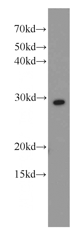 HEK-293 cells were subjected to SDS PAGE followed by western blot with Catalog No:114899(RPL7 antibody) at dilution of 1:1500