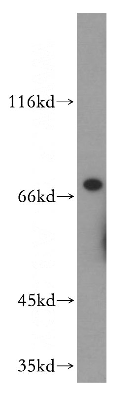 mouse colon tissue were subjected to SDS PAGE followed by western blot with Catalog No:116565(UIMC1 antibody) at dilution of 1:300
