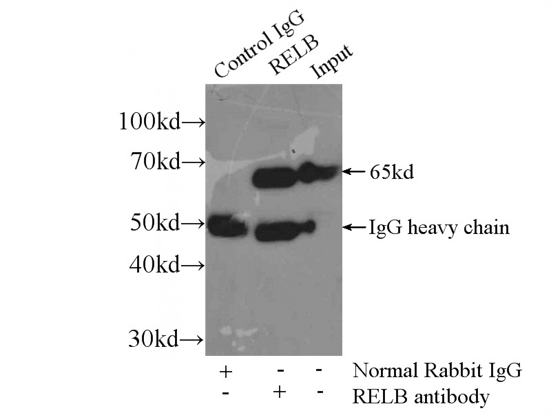 IP Result of anti-RELB (IP:Catalog No:114684, 3ug; Detection:Catalog No:114684 1:300) with Raji cells lysate 2500ug.