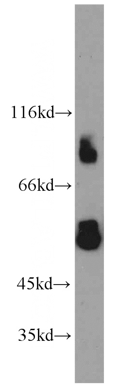 HepG2 cells were subjected to SDS PAGE followed by western blot with Catalog No:111628(IFNGR1 antibody) at dilution of 1:500