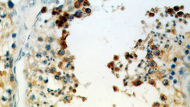 Immunohistochemical of paraffin-embedded human testis using Catalog No:117214(BOLL antibody) at dilution of 1:50 (under 40x lens)