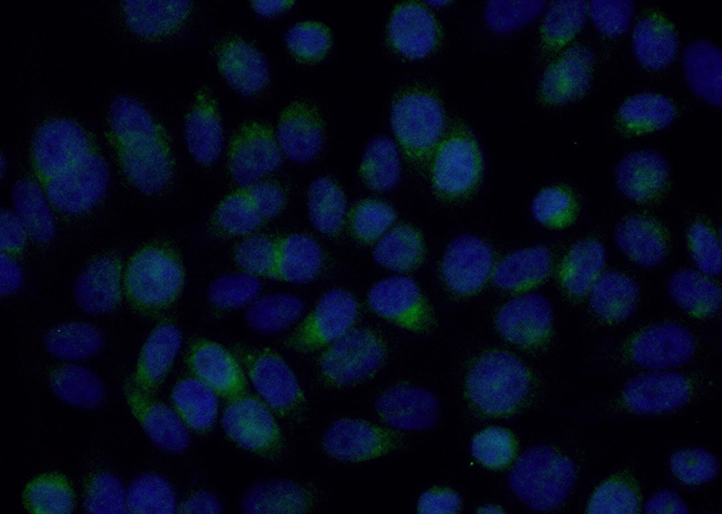 Immunofluorescent analysis of (10% Formaldehyde) fixed HeLa cells using Catalog No:114463(RAB9A Antibody) at dilution of 1:50 and Alexa Fluor 488-congugated AffiniPure Goat Anti-Rabbit IgG(H+L)