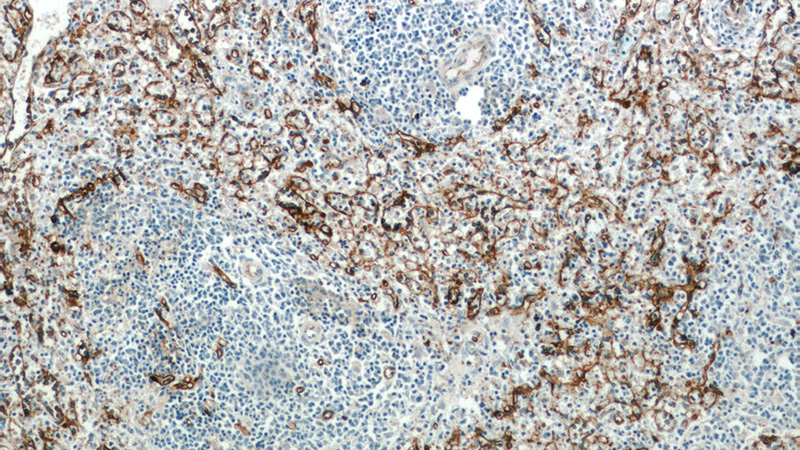 Immunohistochemical of paraffin-embedded human spleen using Catalog No:109031(CD36 antibody) at dilution of 1:50 (under 10x lens)