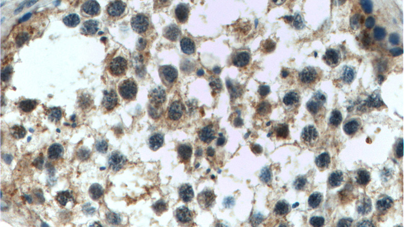 Immunohistochemistry of paraffin-embedded human testis tissue slide using Catalog No:108807(C9orf98 Antibody) at dilution of 1:50 (under 40x lens)