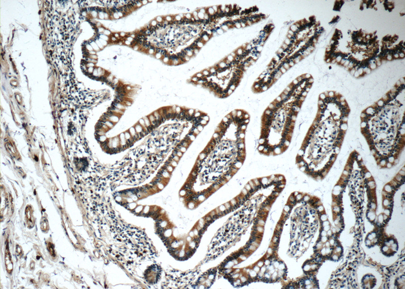 Immunohistochemistry of paraffin-embedded human small intestine tissue slide using Catalog No:108849(CPA3 Antibody) at dilution of 1:50 (under 10x lens)