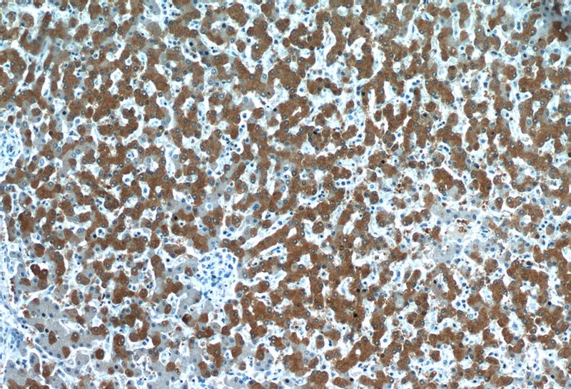 Immunohistochemistry of paraffin-embedded human liver slide using Catalog No:114685(RELN Antibody) at dilution of 1:50(under 10x lens)