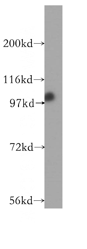 K-562 cells were subjected to SDS PAGE followed by western blot with Catalog No:116980(XAB2 antibody) at dilution of 1:200