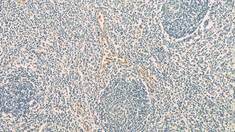Immunohistochemistry of paraffin-embedded human tonsillitis tissue slide using Catalog No:109148(CD93 Antibody) at dilution of 1:50 (under 10x lens)