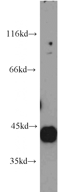 mouse brain tissue were subjected to SDS PAGE followed by western blot with Catalog No:111338(HAPLN4 antibody) at dilution of 1:1200