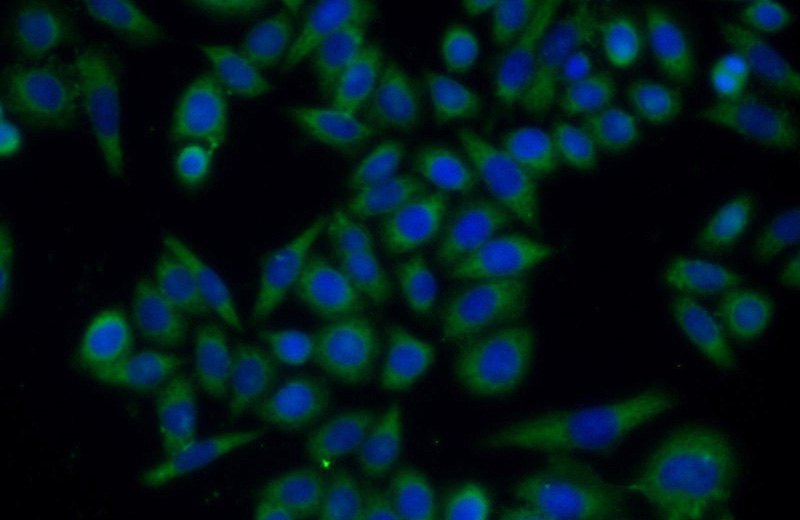 Immunofluorescent analysis of HeLa cells using Catalog No:116091(TMEM106B Antibody) at dilution of 1:50 and Alexa Fluor 488-congugated AffiniPure Goat Anti-Rabbit IgG(H+L)