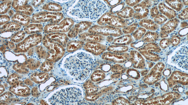 Immunohistochemistry of paraffin-embedded human kidney tissue slide using Catalog No:108365(BAX Antibody) at dilution of 1:50 (under 10x lens)