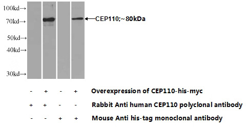 Transfected HEK-293 cells were subjected to SDS PAGE followed by western blot with Catalog No:109263(CEP110 Antibody) at dilution of 1:700