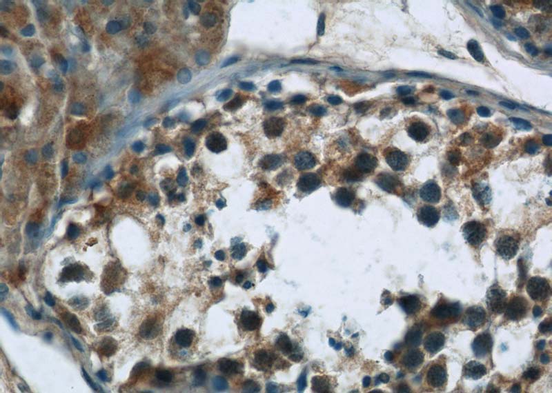 Immunohistochemistry of paraffin-embedded human testis tissue slide using Catalog No:108192(ARID4B Antibody) at dilution of 1:50 (under 40x lens)