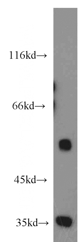 NIH/3T3 cells were subjected to SDS PAGE followed by western blot with Catalog No:109167(CDK8 antibody) at dilution of 1:500