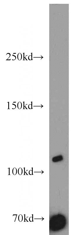 Jurkat cells were subjected to SDS PAGE followed by western blot with Catalog No:115805(SYTL2 antibody) at dilution of 1:500