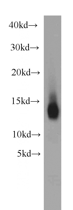 human heart tissue were subjected to SDS PAGE followed by western blot with Catalog No:113072(NDUFB2 antibody) at dilution of 1:1000