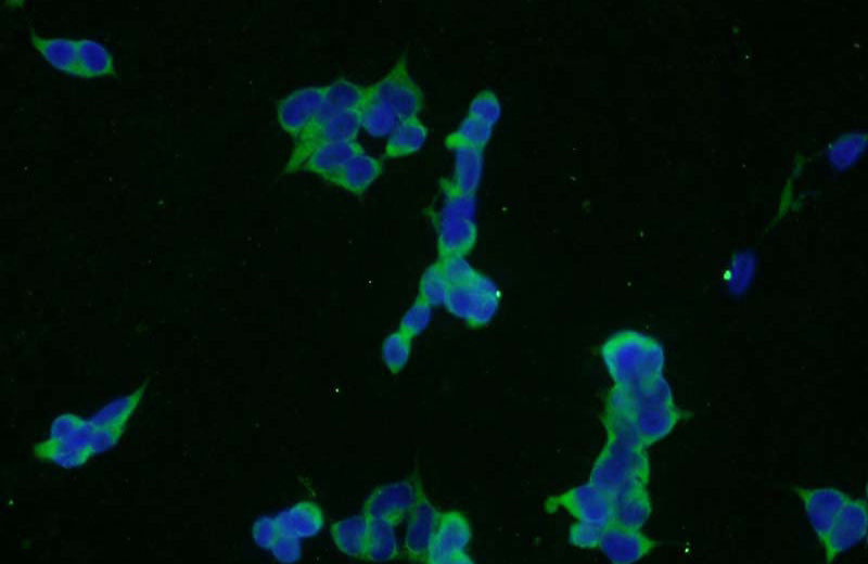 Immunofluorescent analysis of HEK-293 cells using Catalog No:112047(KIAA0368 Antibody) at dilution of 1:50 and Alexa Fluor 488-congugated AffiniPure Goat Anti-Rabbit IgG(H+L)